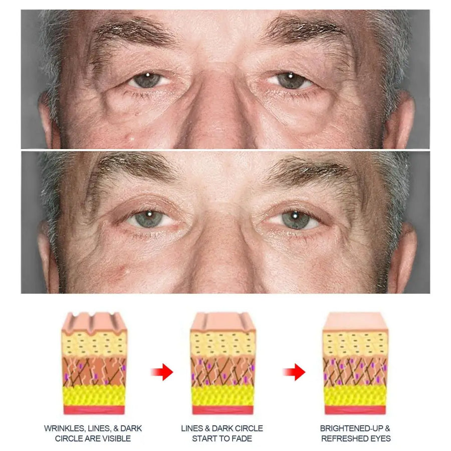 Men’s Anti-aging Eye Cream with Applicator Tip