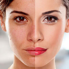 Anti-Aging Solutions - Royalessencelux