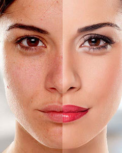 Anti-Aging Solutions - Royalessencelux