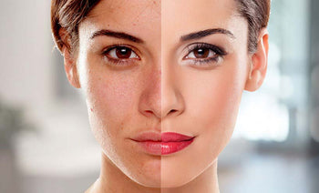 Anti-Aging Solutions - Royalessencelux