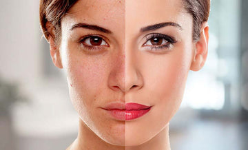 A woman’s face split showing natural skin and makeup side highlighting timeless beauty essentials for a youthful glow.