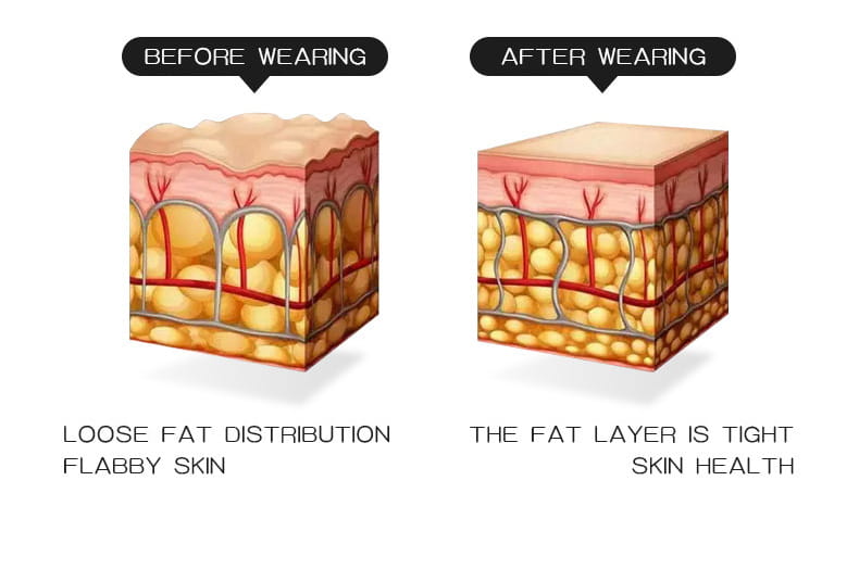 the image compares skin layers before and after using a high waist body shaper tummy control butt lifter, highlighting loose fat and flabby skin versus a tight fat layer and healthy skin for effective fat burning high performance.