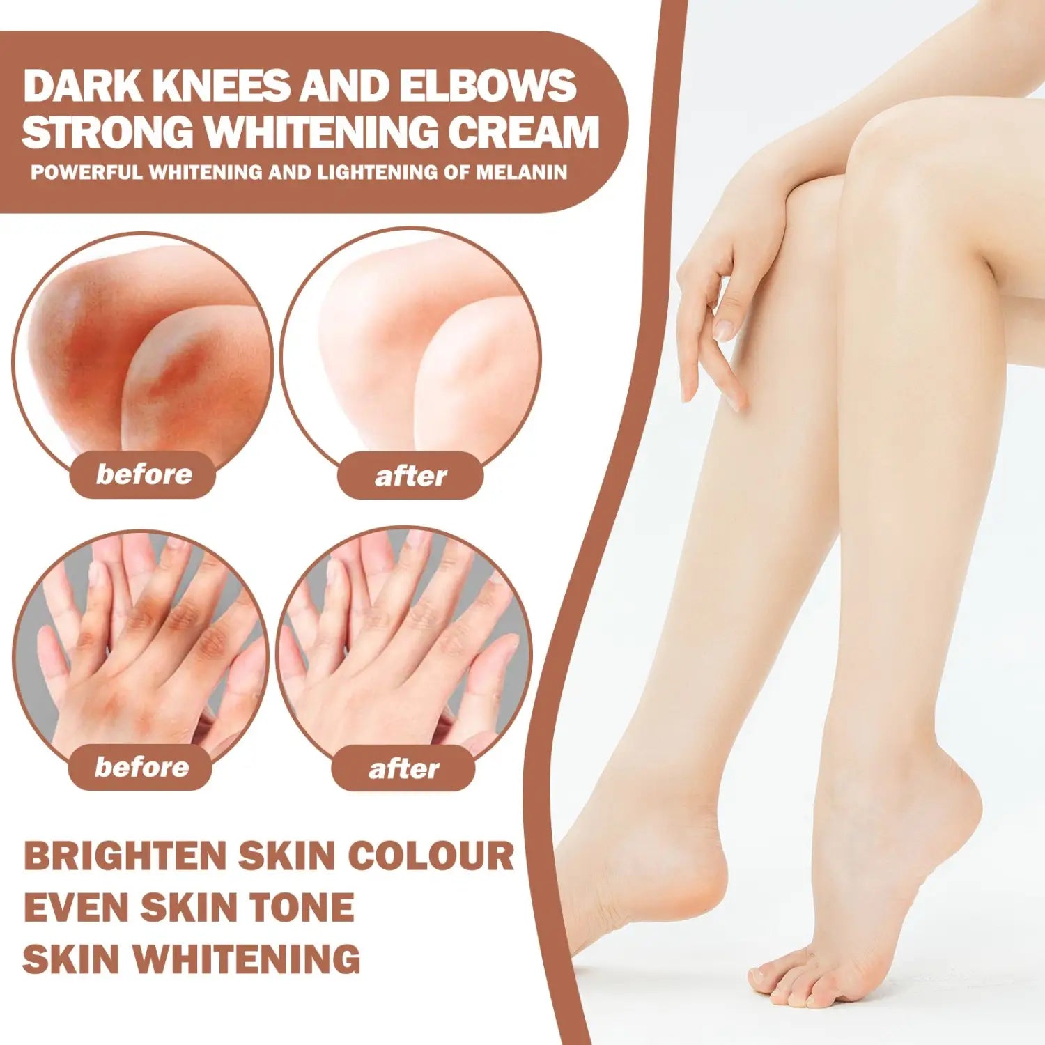 Eelhoe joint darkening and brightening cream for dark knees and elbows offers strong whitening cream for powerful melanin lightening.