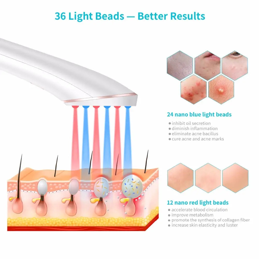 White handheld xpreen wireless blue light acne therapy device with 36 light beads emitting blue and red beams for skin light therapy treatment