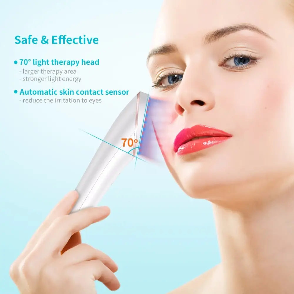Silver-toned handheld xpreen wireless blue light acne light therapy device with 70-degree angled head for effective light therapy treatment.