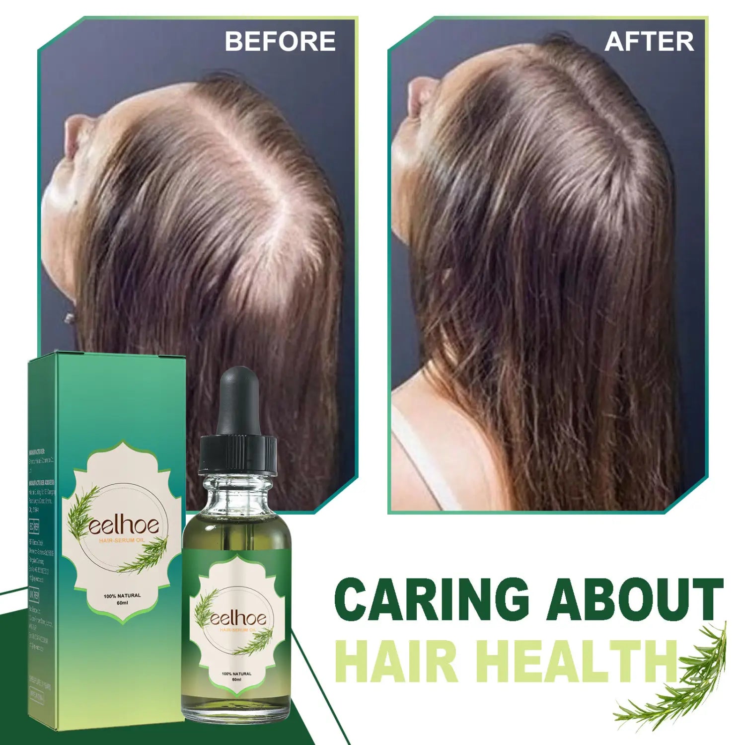 Green glass bottle with black dropper cap and matching green box labeled eelhoe containing nourishing anti-hair loss hair care serum with leaf design.
