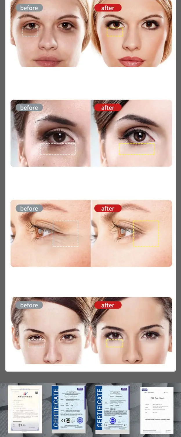 The image shows before-and-after results of facial treatments using a 5-in-1 360 degrees rotary eye massage wand with therapeutic warmth, highlighting improved skin texture and tone around the eyes and forehead.