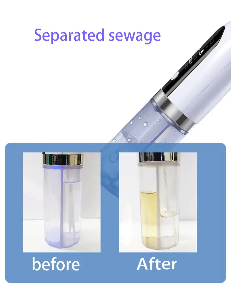white and silver handheld face vacuum with transparent cylindrical body showing liquid before and after filtration in oxygen bubble blackhead remover pore vacuum device