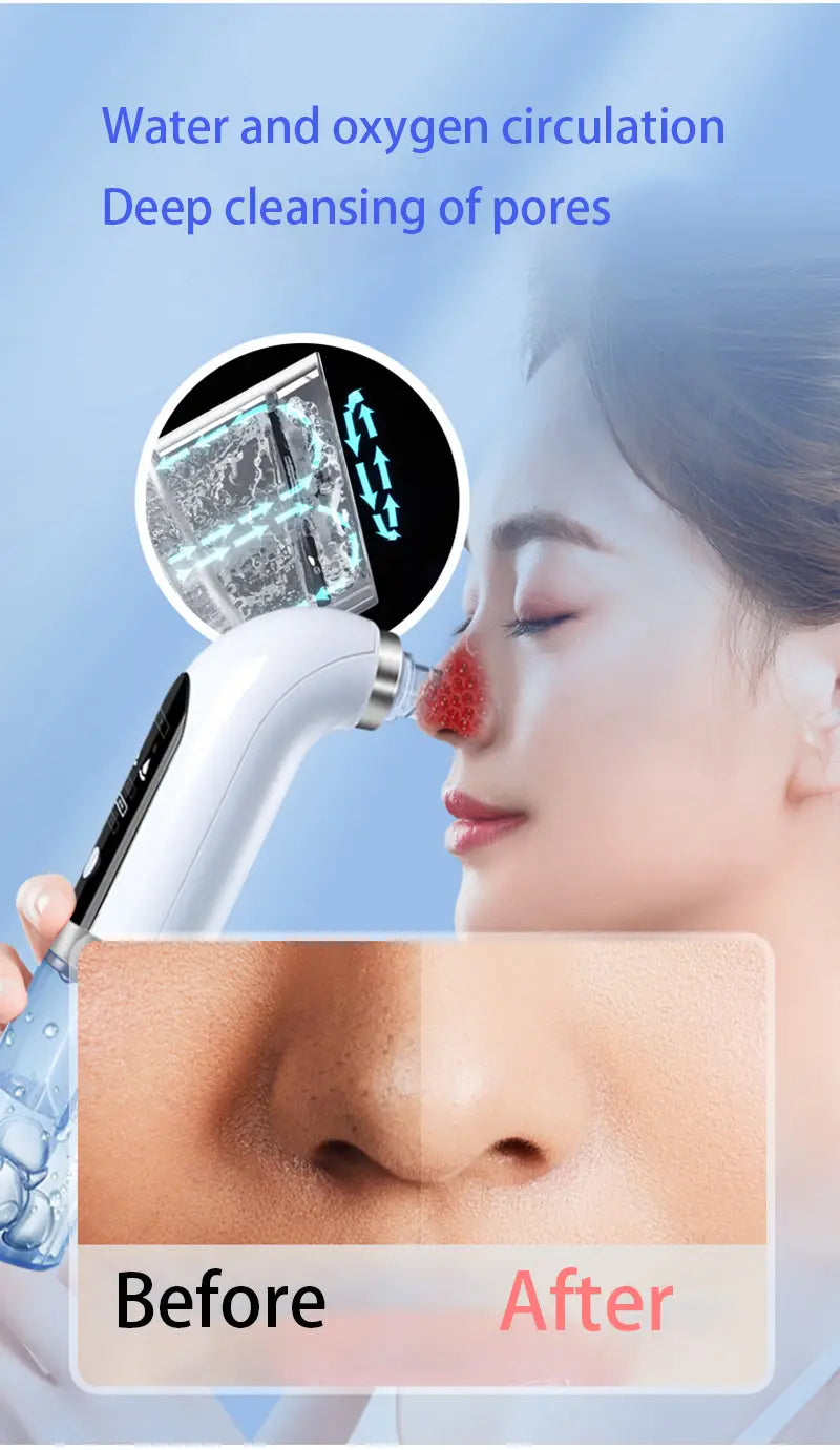 white and silver facial cleansing device with a sleek ergonomic design used as an oxygen bubble blackhead remover pore vacuum and face vacuum for deep skin cleansing