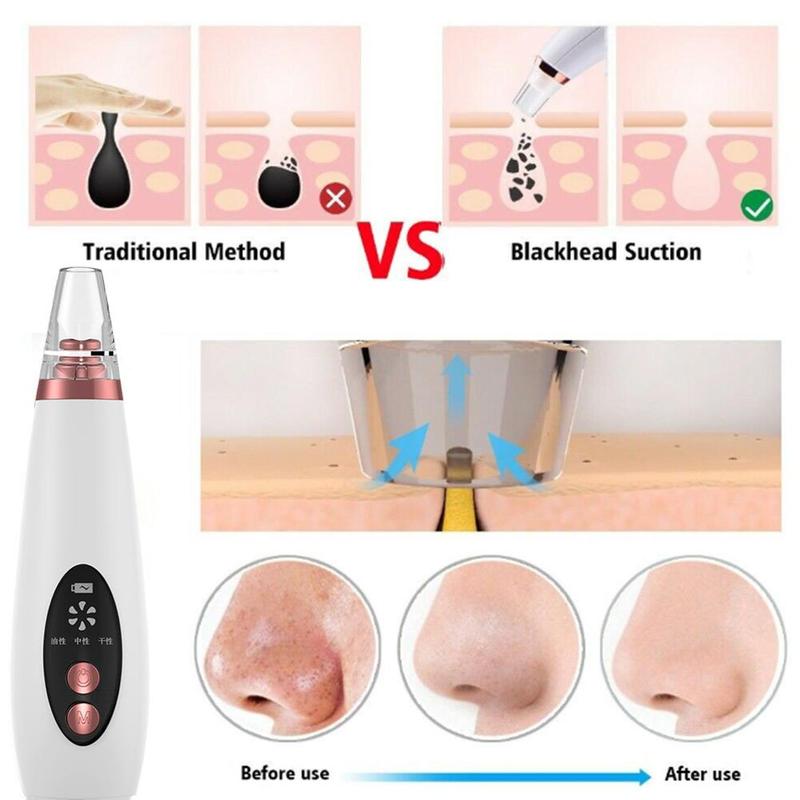 white and rose gold electric pores clean artifact with clear tip for facial pore cleaning and nose vacuum use in cosmetic artifact household
