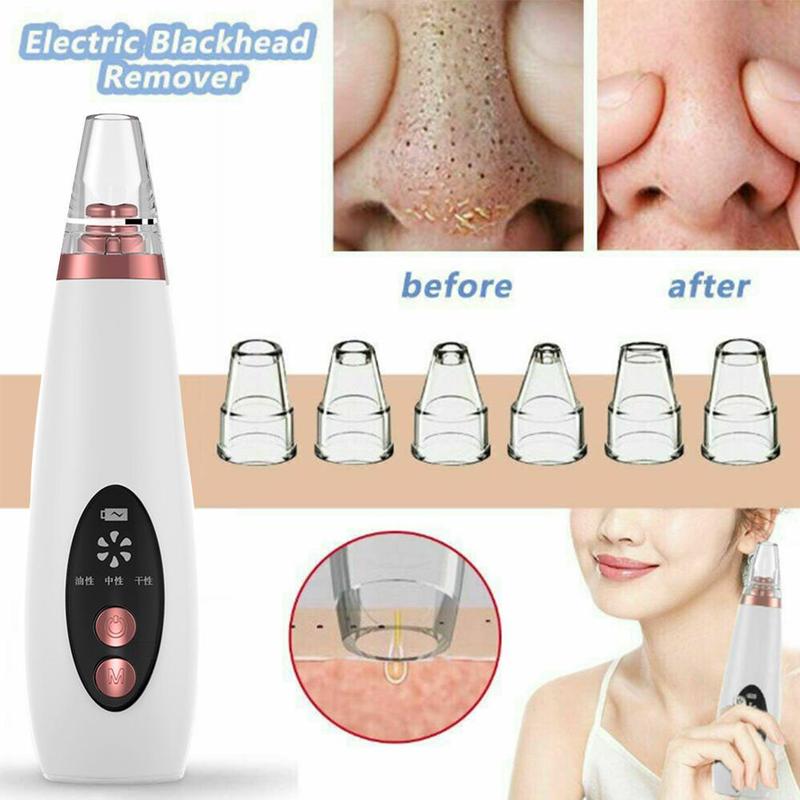 white and rose gold electric pores clean artifact nose vacuum with sleek ergonomic design for household cosmetic use