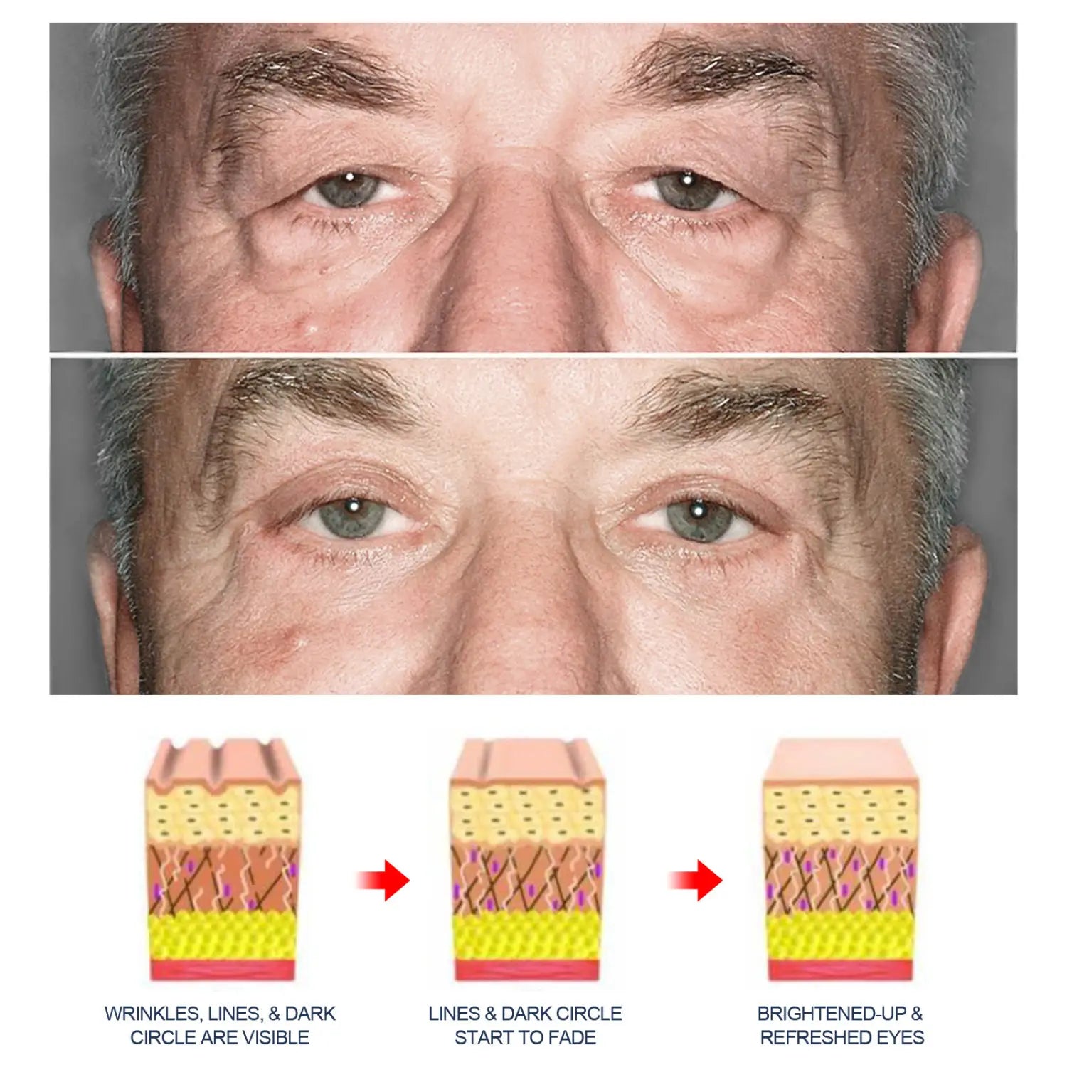 A before and after image of a man’s eyes showing reduced wrinkles fading dark circles and a brighter appearance after using men’s anti-aging eye cream with applicator tip.