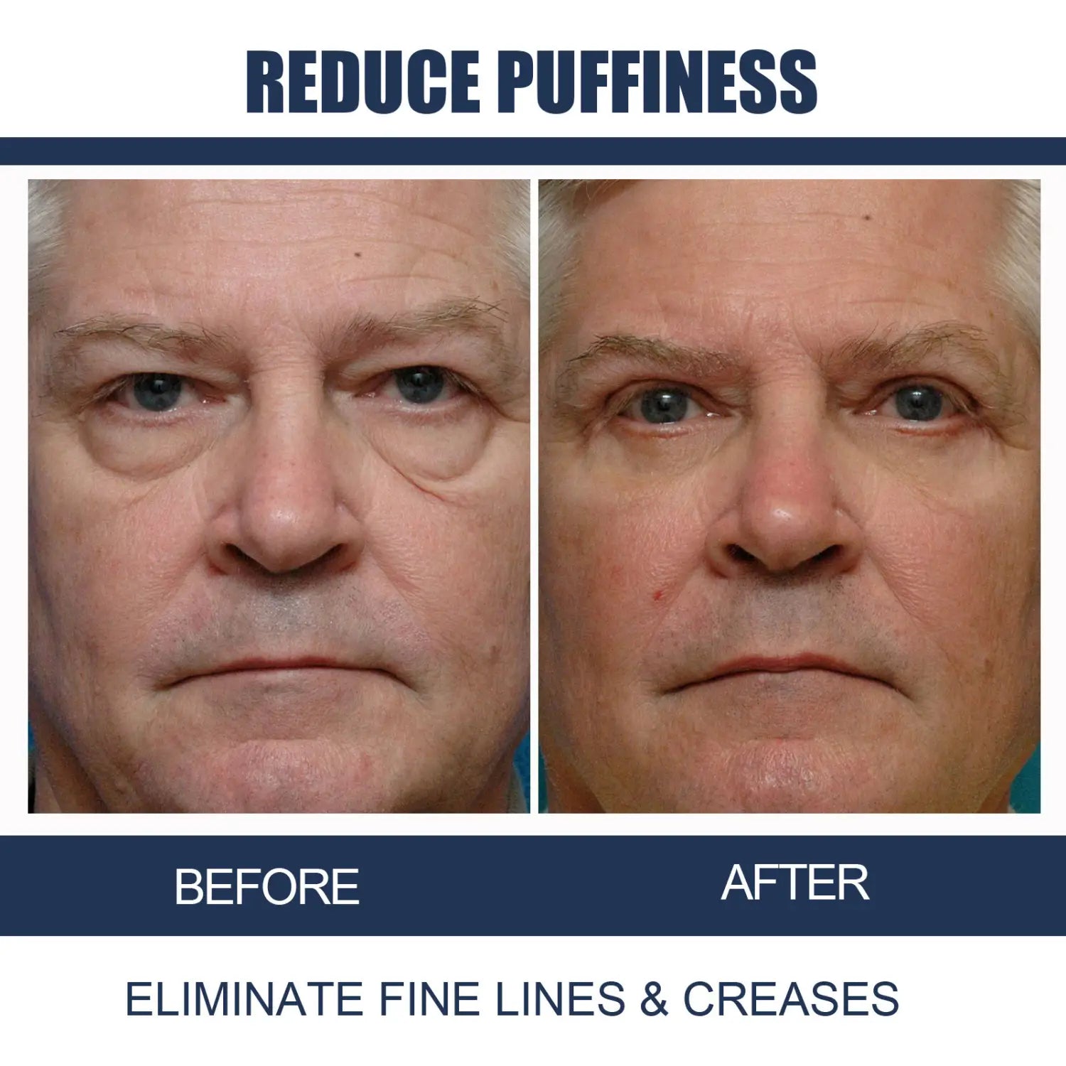 Before and after comparison of a man’s face showing reduced puffiness fine lines and creases after using men’s anti-aging eye cream with applicator tip.