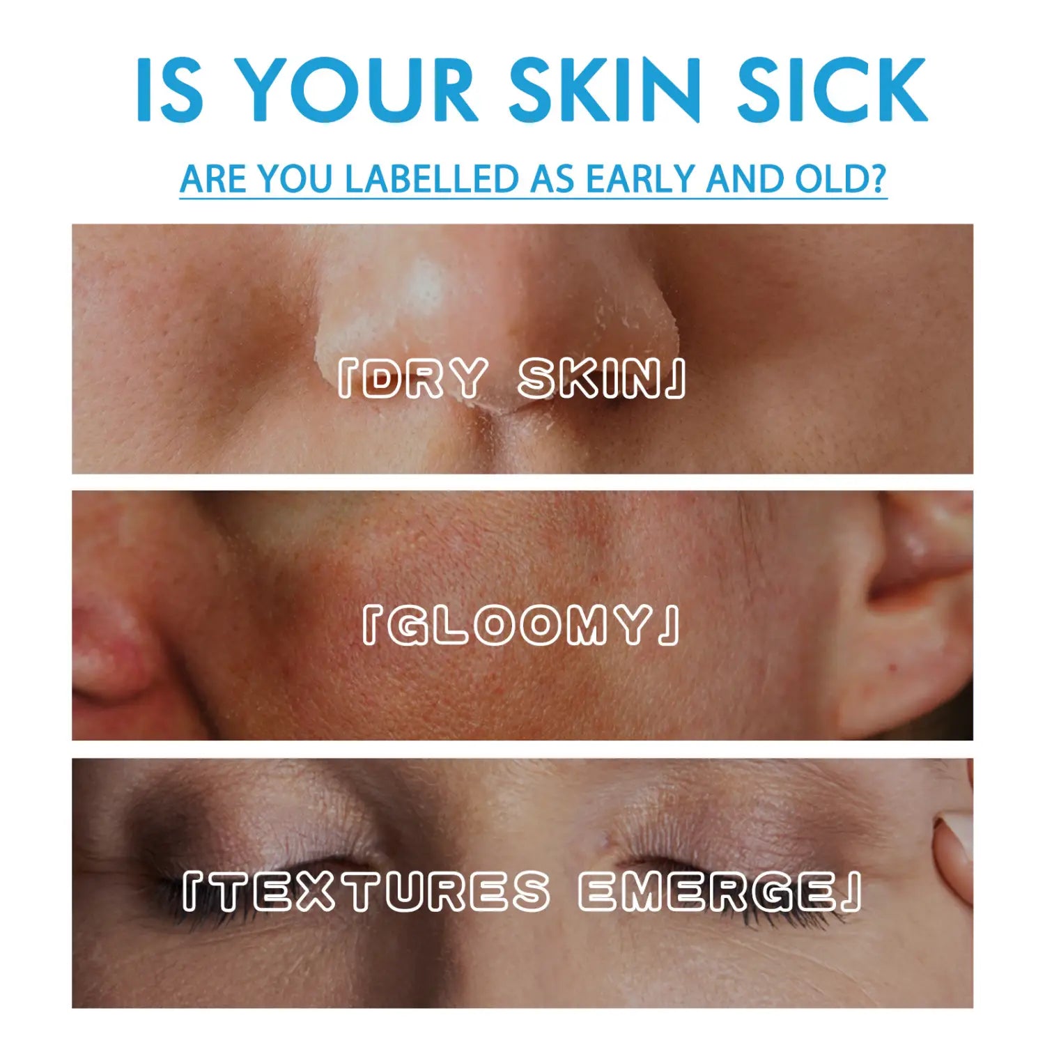 a close-up of human skin showing dryness and dullness treated with blue copper peptide fading wrinkle moisturizing cream designed for fading wrinkle and anti-wrinkle care.