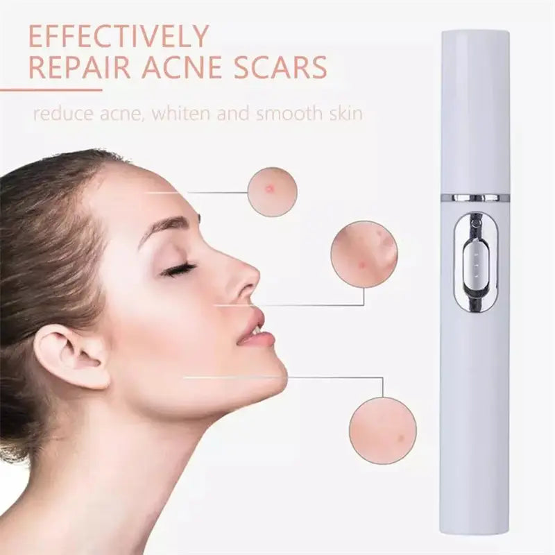 A sleek light gray handheld blue light therapy acne laser pen with a silver accent band and button designed for light therapy acne treatment.