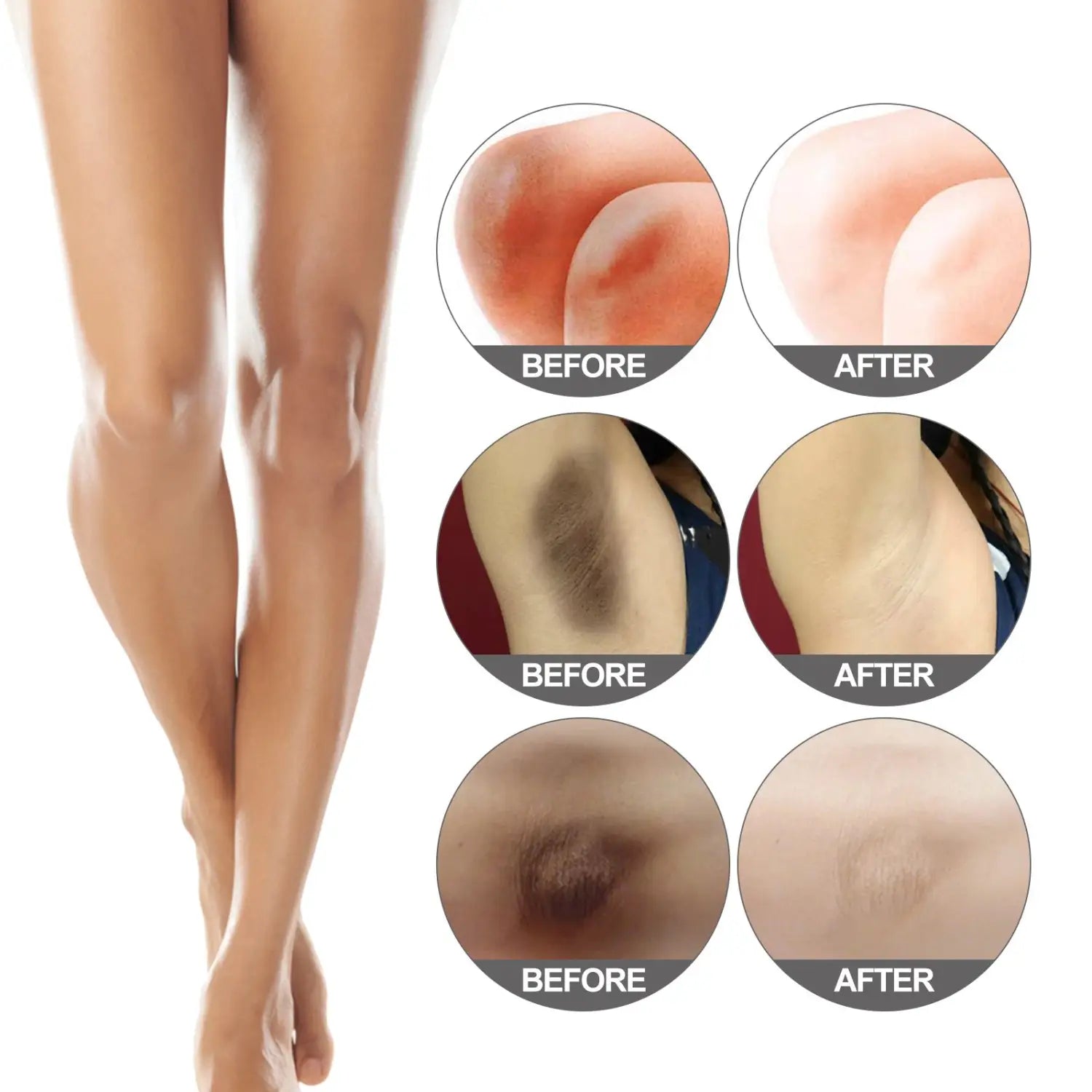 before-and-after comparison showing the effectiveness of thighs darkening cream in lightening knees, underarms, and thighs as cream lightens underarms and body areas.