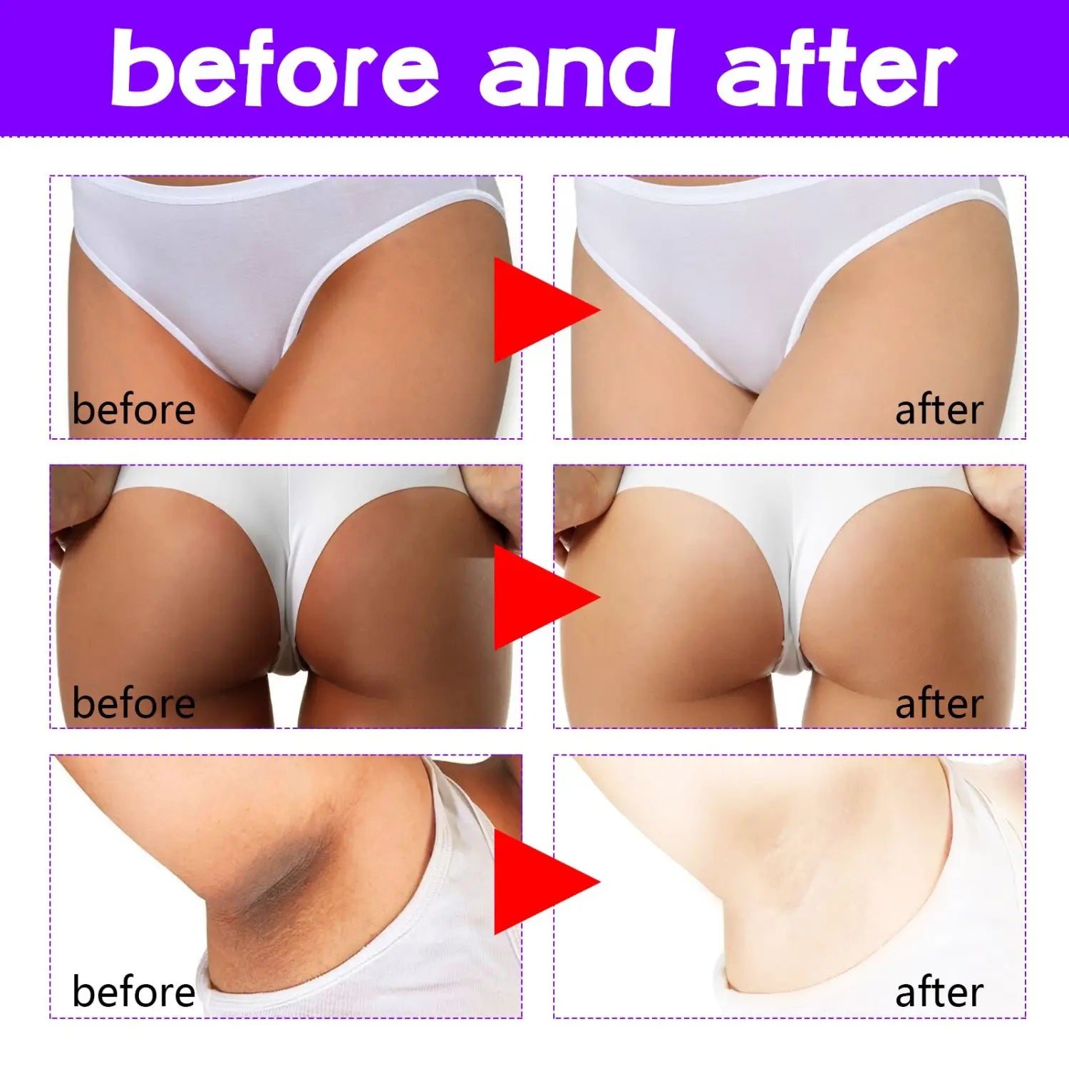 white seamless underwear displayed with thigh skin perfecting cream lightens melanin designed for smooth skin perfecting results