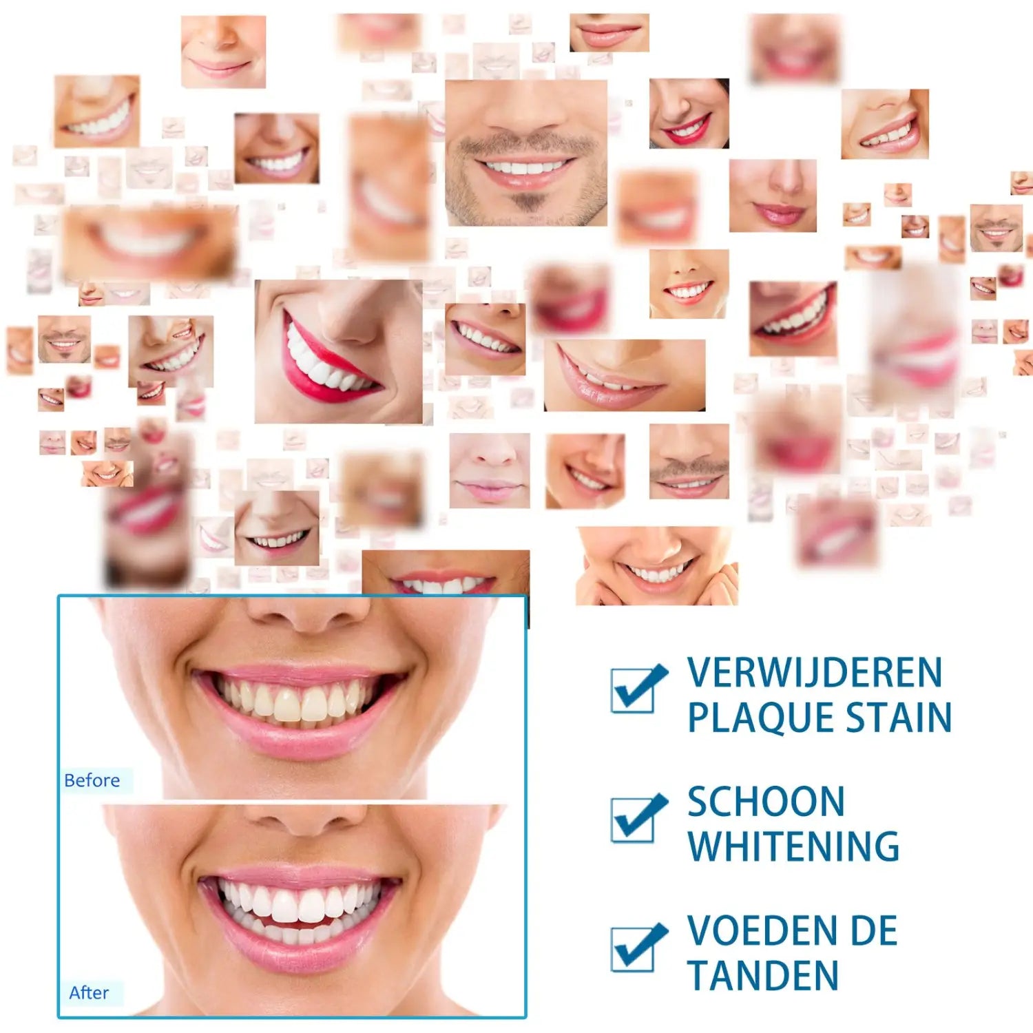 A woman smiling with glossy pink lips and neatly aligned white teeth after using a teeth whitening pen for stained teeth and plaque.