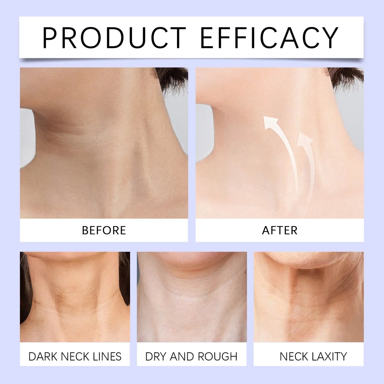 an anti-aging neck cream smoothing fine lines shown in before-and-after comparisons highlighting diminished dark lines dryness roughness and laxity on neck skin.