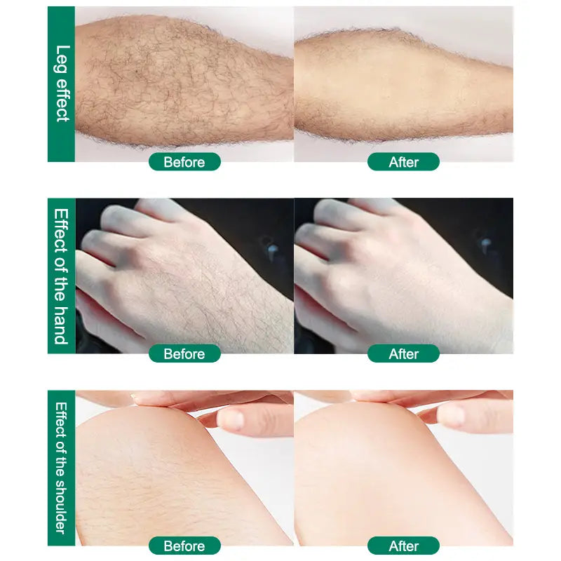 before and after images demonstrate the effectiveness of the teal nano glass crystal hair eraser removal tool in hair removal on legs hands and shoulders using advanced crystal hair technology.