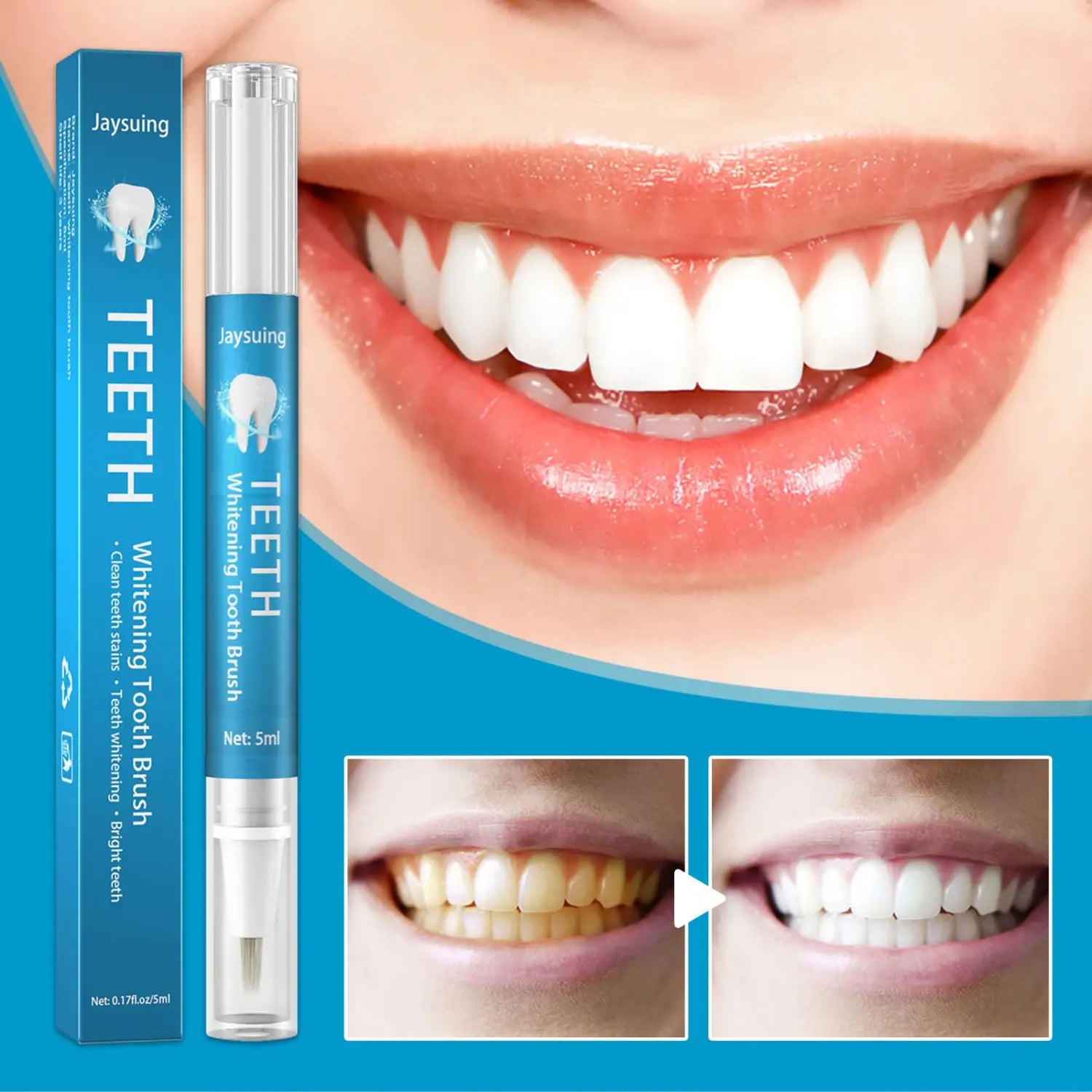 blue and white teeth whitening pen with a clear cap and brush head packaged in a matching blue box designed for whitening stained teeth and plaque removal
