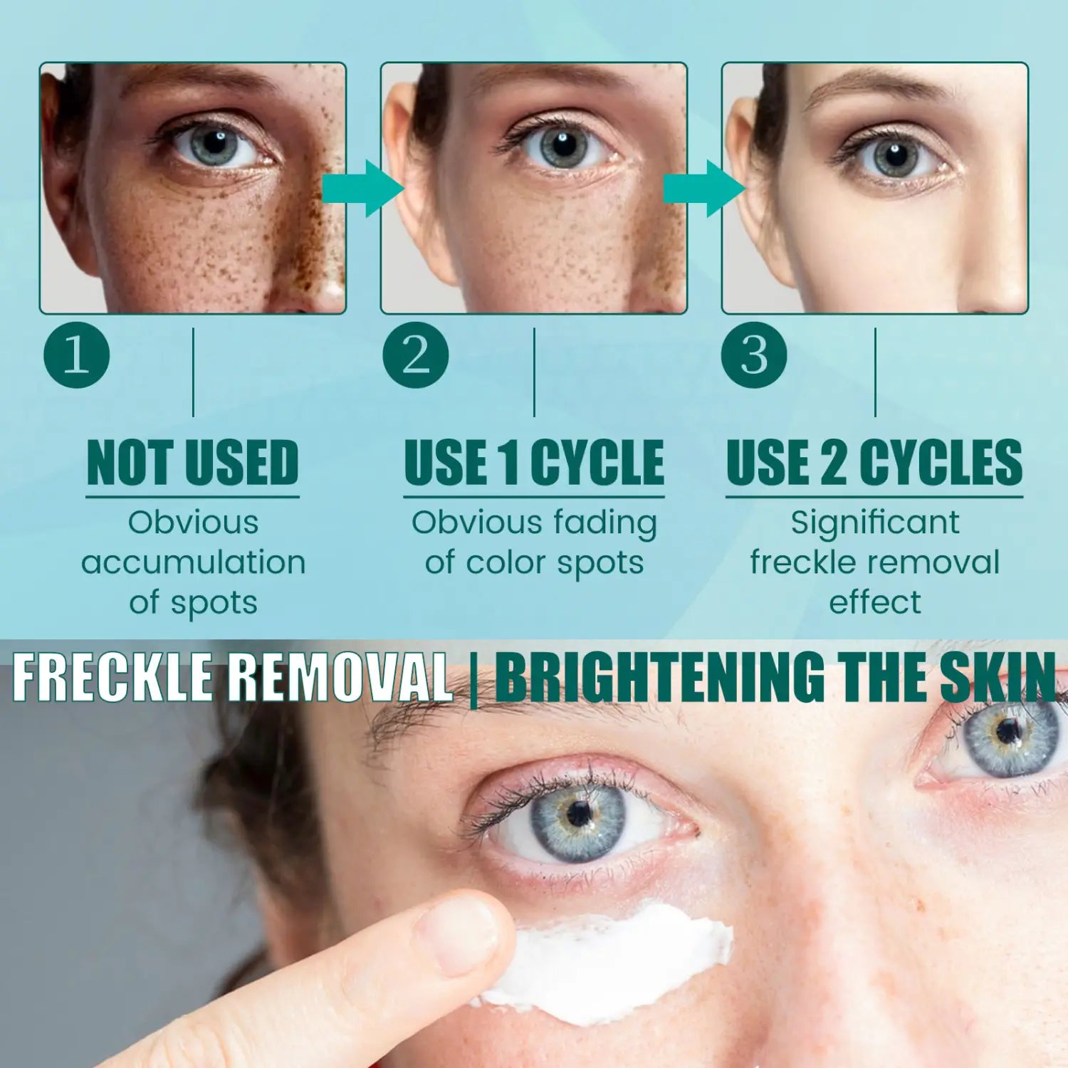 white cream from south moon brightening spot whitening cream being applied to the under-eye area for freckle removal and skin brightening