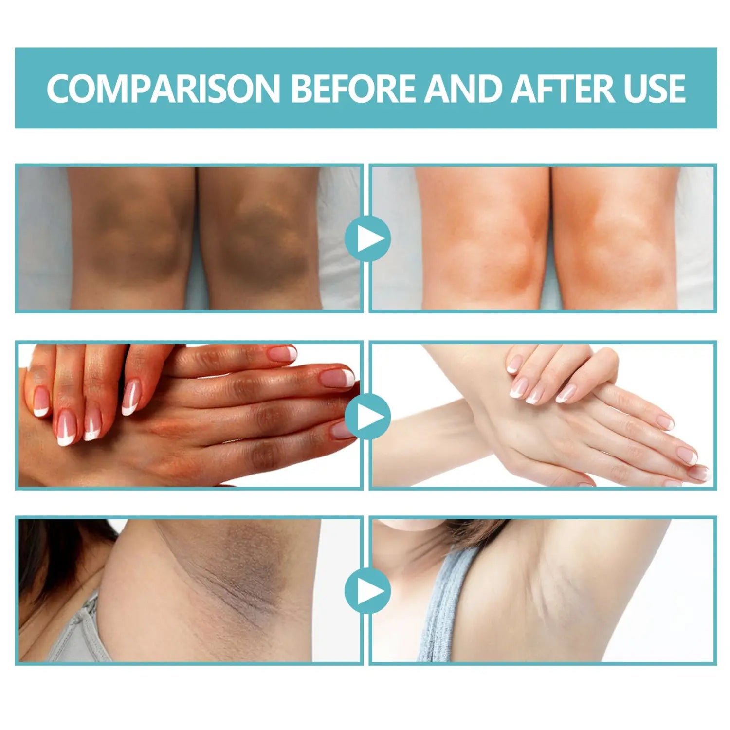 The image shows a before-and-after comparison of skin areas treated with black echinacea repair cream for body whitening, highlighting improved clarity and brightness on knees, hands, and underarms.