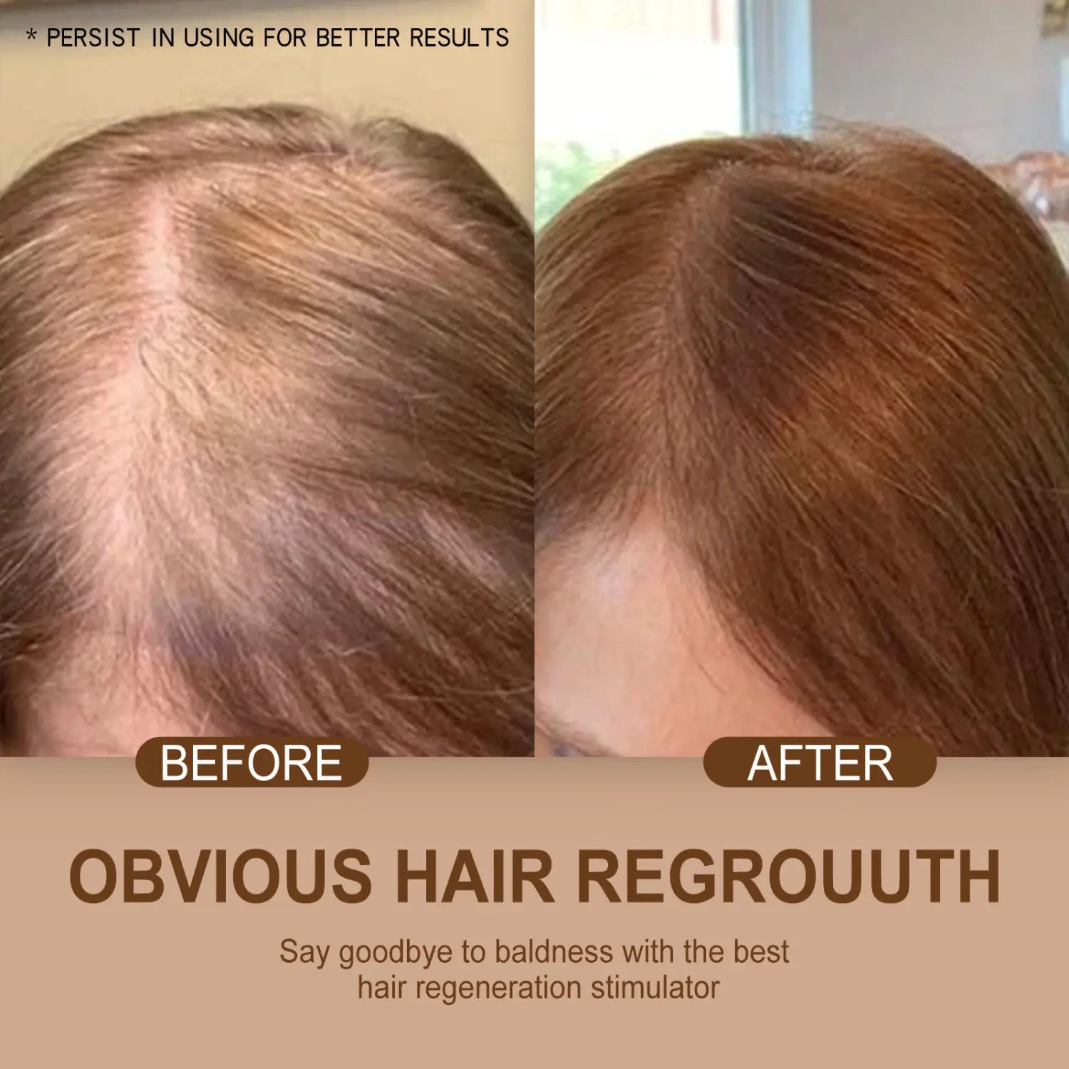 The image shows a before and after comparison of hair regrowth from a thinning scalp to fuller reddish brown hair using hoegoa moroccan hair care for smooth waves.