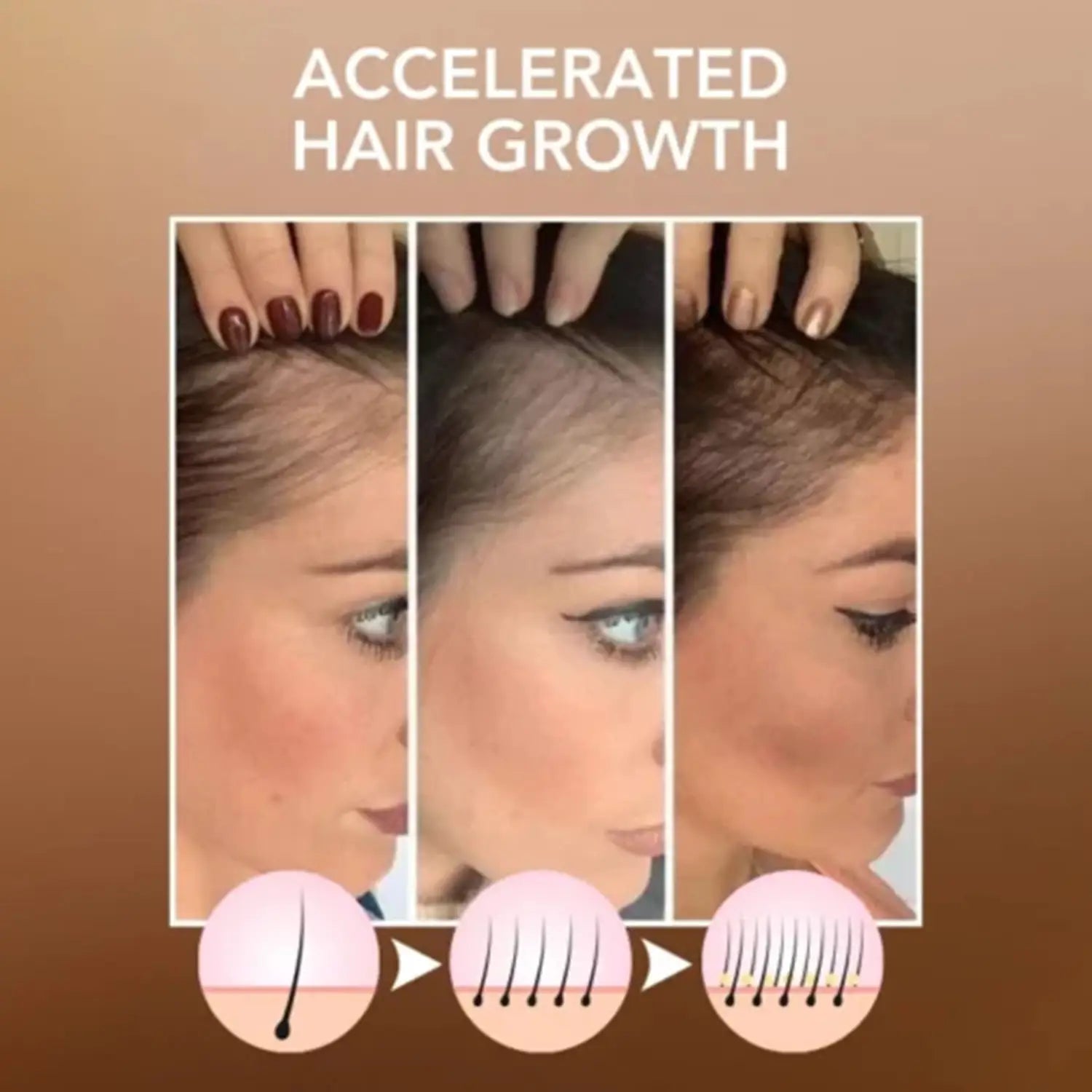 advertisement for hoegoa moroccan hair care accelerated hair growth product showing a woman’s scalp transitioning from thinning to fuller smooth dark brown hair for enhanced moroccan hair care results.