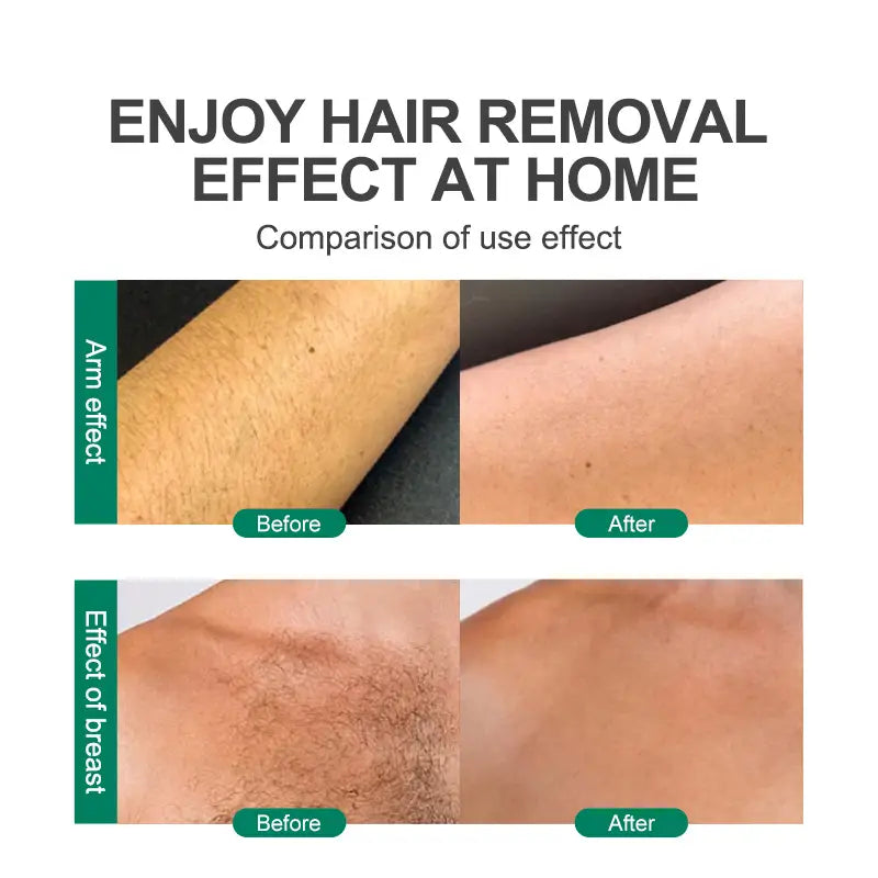 The image shows a before-and-after comparison of effective hair removal on arm and breast areas using the teal nano glass crystal hair eraser removal tool.