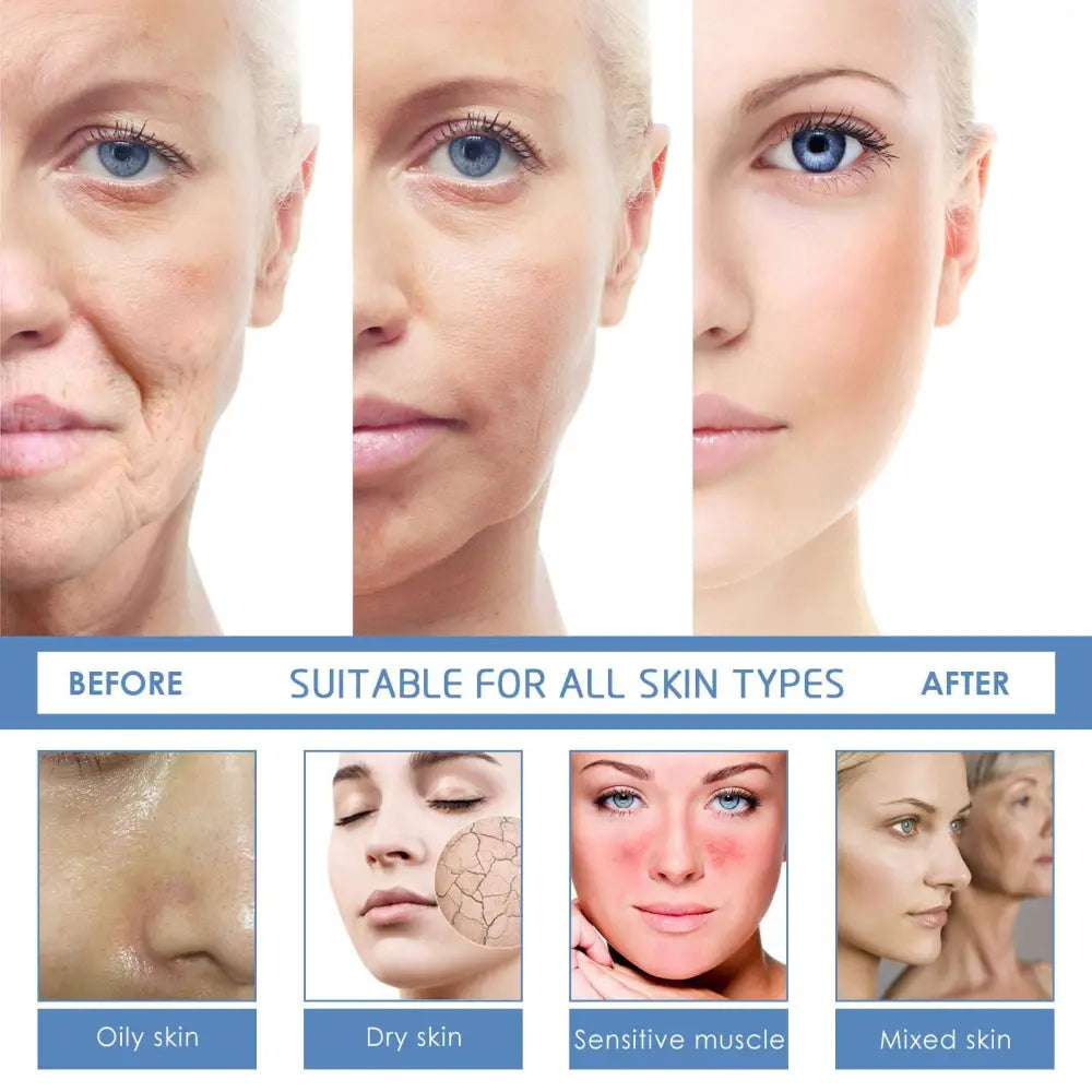 Anti-aging facial firming serum by jaysuing showing before and after results on oily dry sensitive and mixed skin types