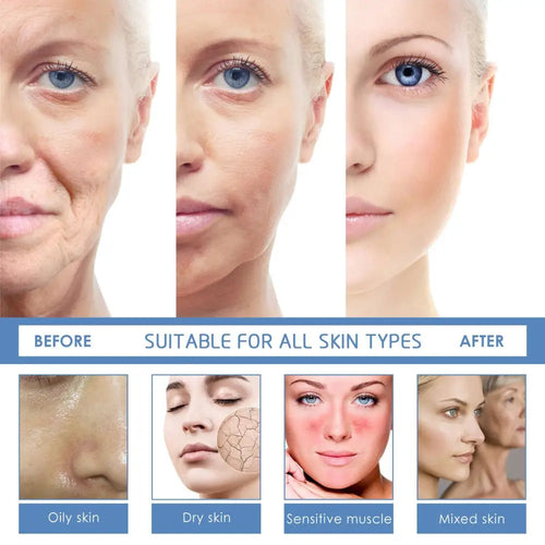 Anti-aging facial firming serum by jaysuing showing before and after results on oily dry sensitive and mixed skin types