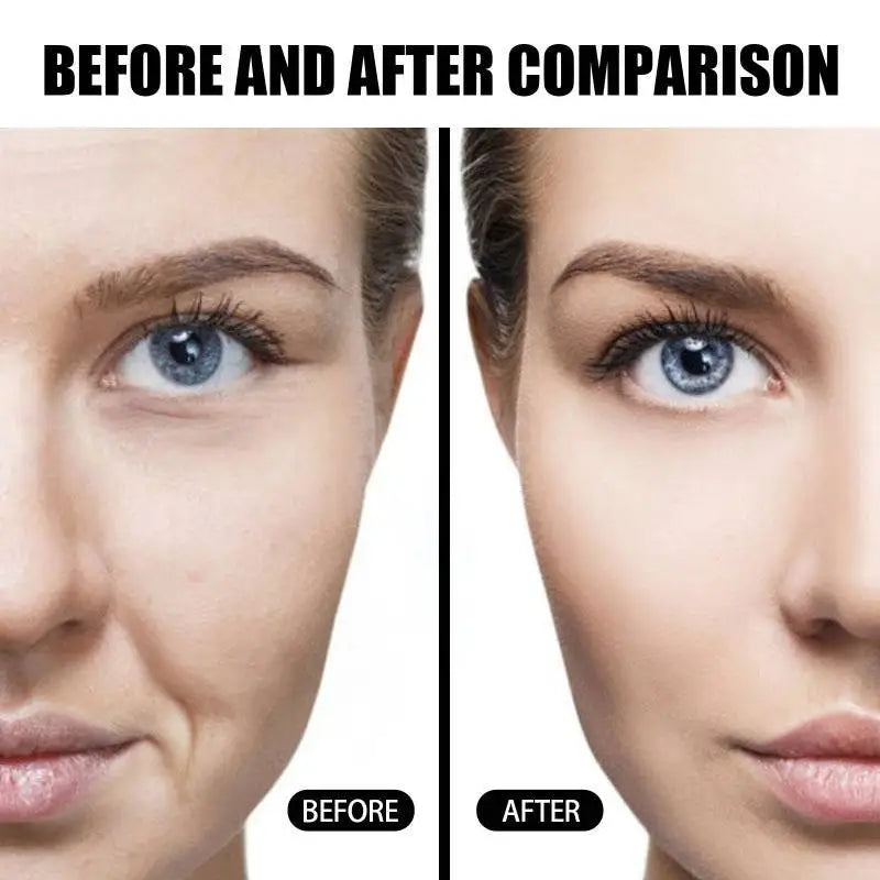 Smooth skin-toned facial treatment mask applied for anti-aging skin rejuvenation and fading wrinkle in water bank set