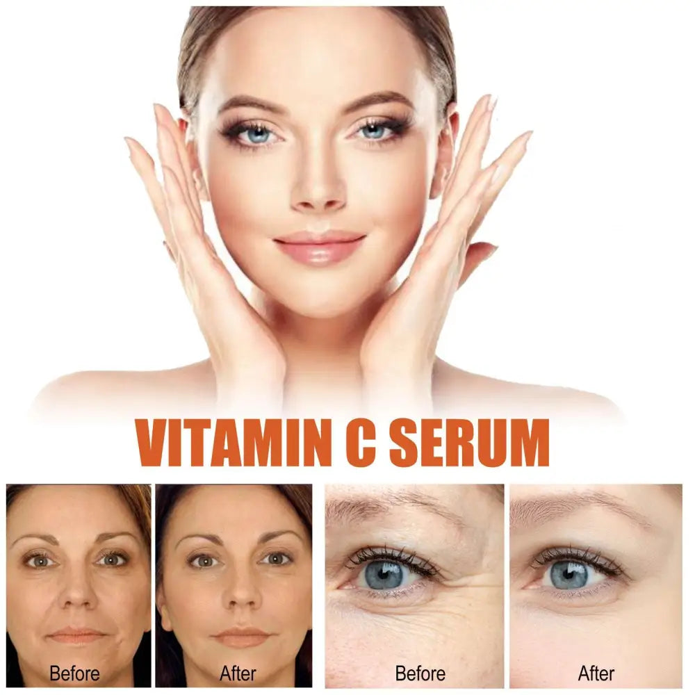 Silver and white eelhoe anti-aging whitening vitamin c care serum bottle with pump dispenser 30ml volume