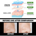 The bamboo charcoal blackhead removal peel-off mask shows skin texture rejuvenation with labeled skin layers