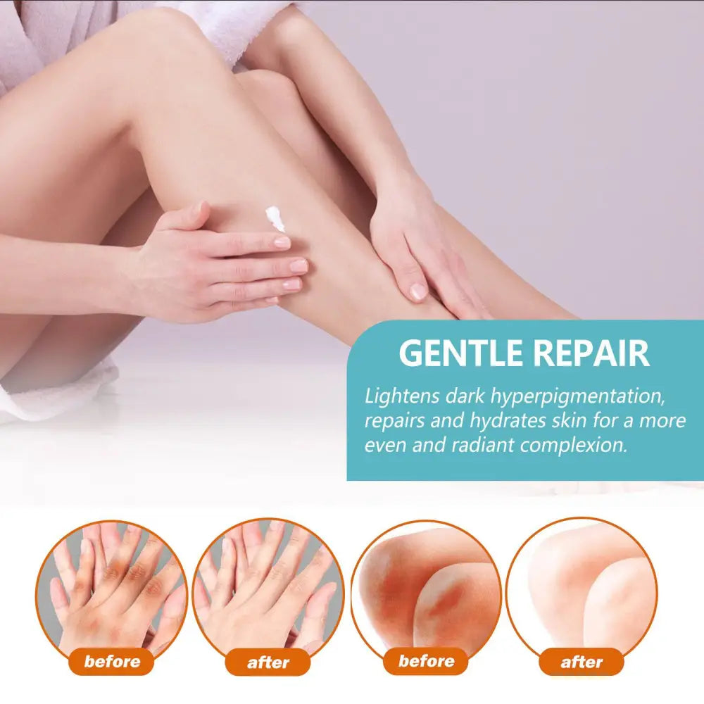 A creamy black echinacea repair cream applied on a leg showing before and after results for dark hyperpigmentation