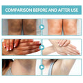 Before and after images show skin lightening on knees hands and underarms using black echinacea repair cream for body whitening