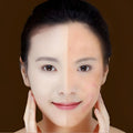 Split-face comparison showing clear and acne-prone skin using a white cylindrical blue light therapy acne laser pen