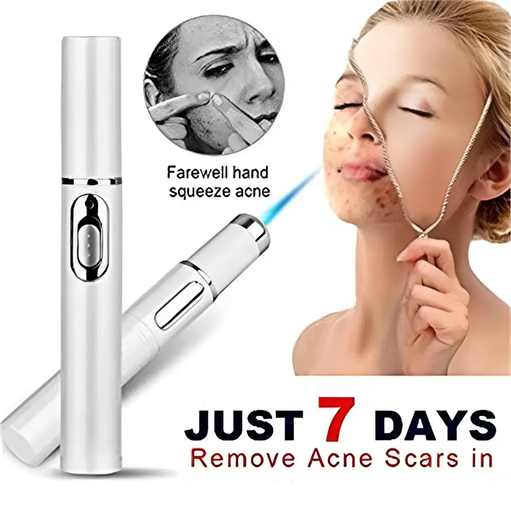 Silver handheld acne laser pen with sleek cylindrical design and side button for light therapy acne treatment