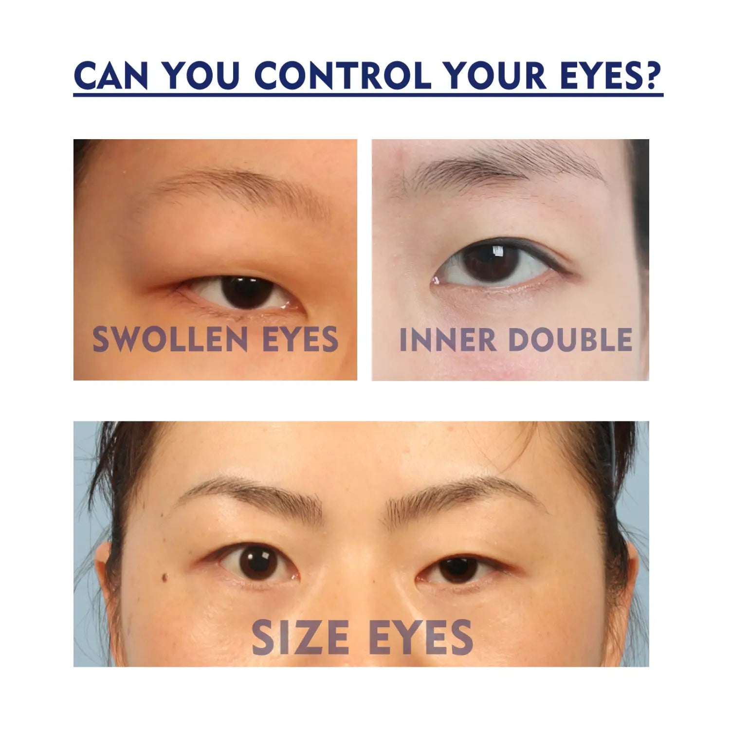 the image shows a before and after comparison of eye appearance using eelhoe double eyelid fixing cream highlighting effects on swollen eyes and natural double eyelids.