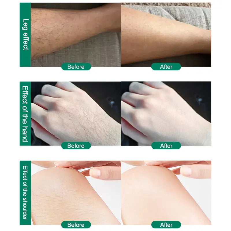 the teal nano glass crystal hair eraser removal tool is shown in a before-and-after comparison demonstrating effective hair removal with smoother and lighter skin on legs hands and shoulders.