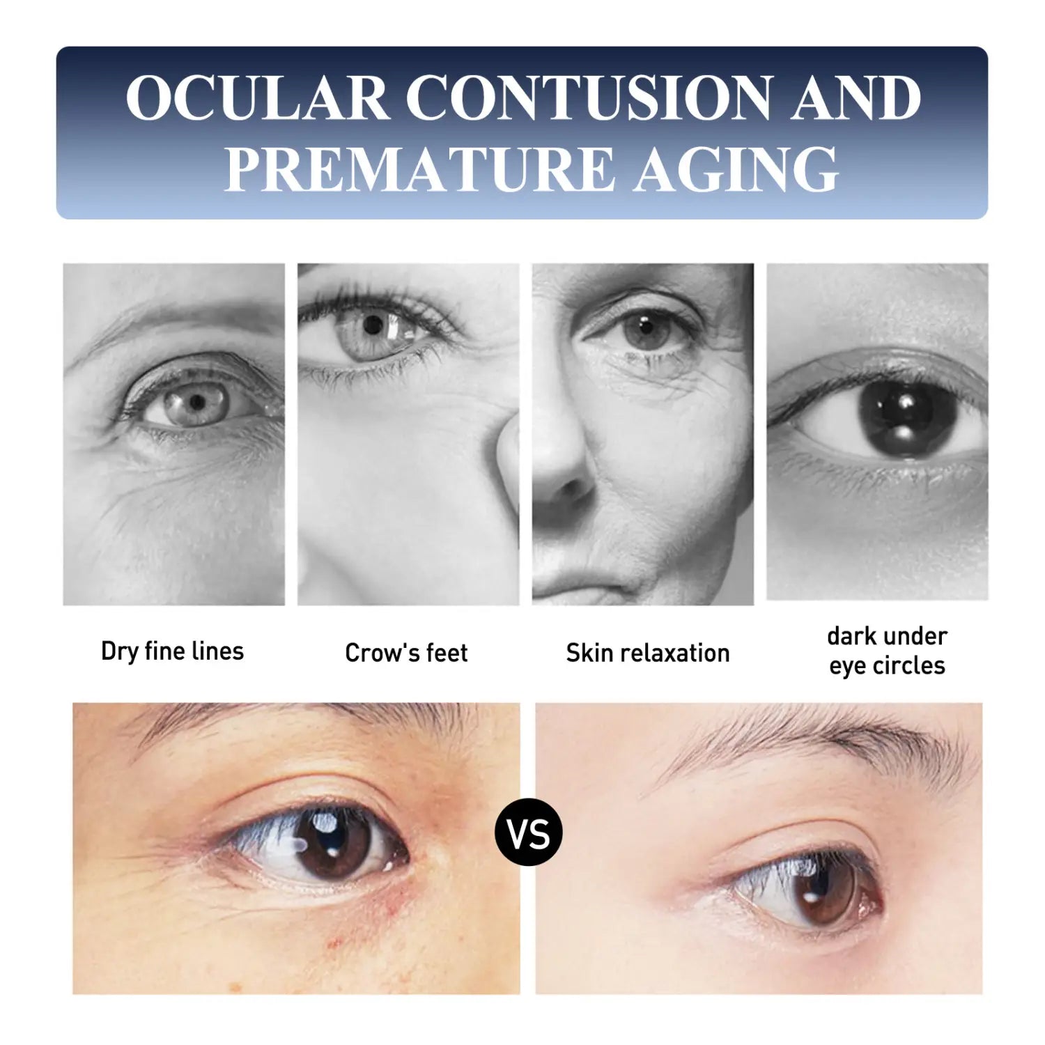 The image shows black-and-white and color close-ups illustrating signs of ocular contusion and premature aging such as dry fine lines, crow’s feet, skin relaxation, and dark under-eye circles for a moisturizing cream lifting and tightening fine lines with fine lines repair benefits.