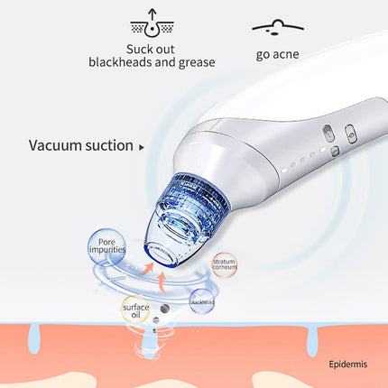 Blackhead Suction Instrument, Electric Blackhead Suction Artifact, Blackhead Removal Instrument, Home Use Beauty Instrument For Sucking Blackheads And Acne - Royalessencelux