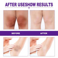 The image shows before and after results of eelhoe rejuvenator areola intimate area essence reducing red pigment discoloration