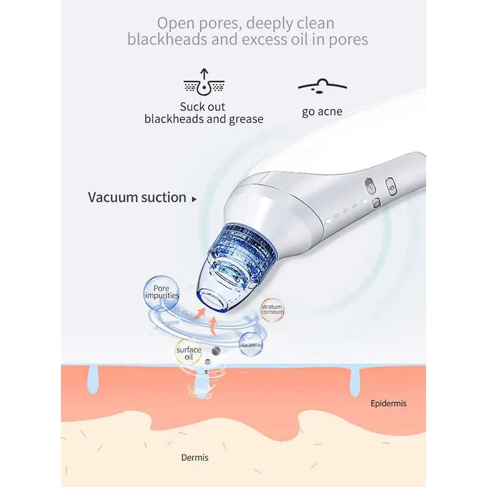 White plastic electric blackhead suction instrument with transparent blue-tinted suction head for effective blackhead removal