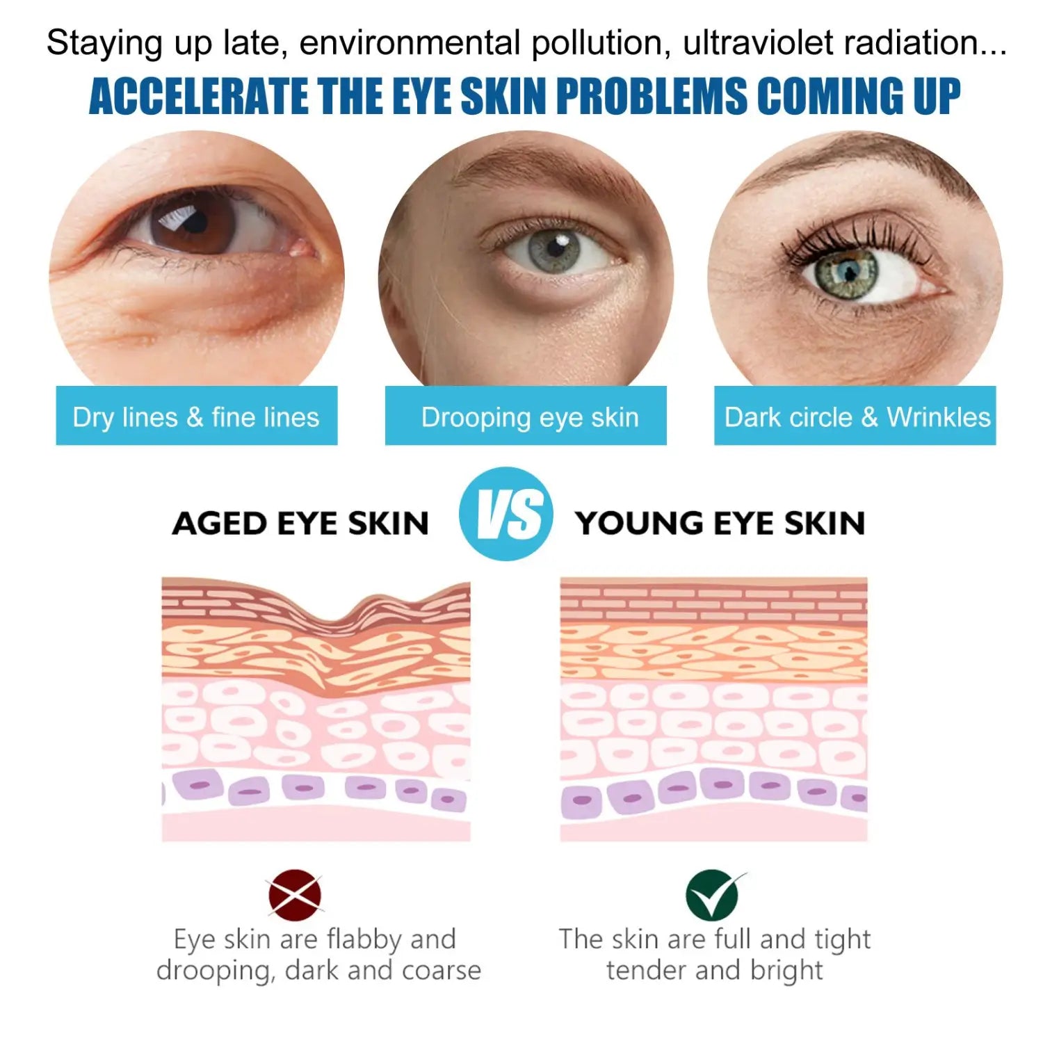 The infographic compares aged and young eye skin with close-up photos and diagrams to highlight the benefits of the glitter collagen eye mask for fine lines and dark circles.