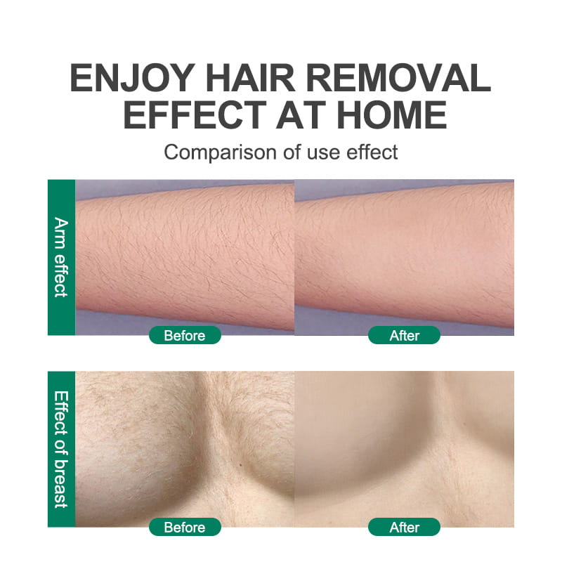 The image shows a before-and-after comparison of hair removal results on an arm and breast area using the teal nano glass crystal hair eraser removal tool effectively.