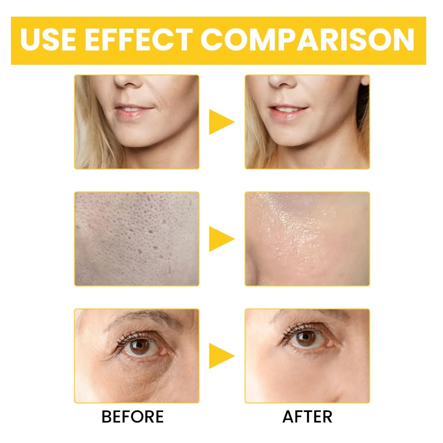 before-and-after comparison showing the effect of eelhoe retinol anti-wrinkle serum with hyaluronic acid on improving skin texture, tone, and reducing fine lines.