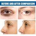 Before and after comparison showing a woman using a glitter collagen eye mask to reduce fine lines and dark circles