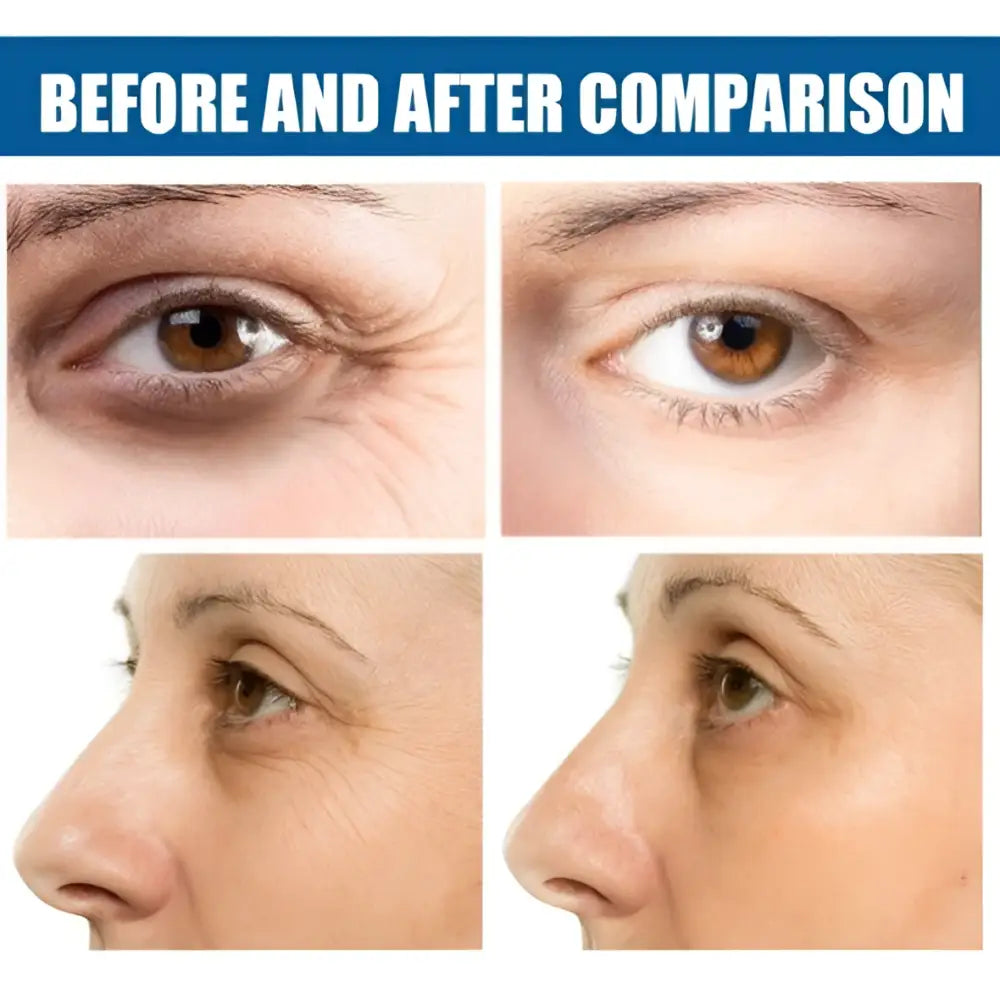 Before and after comparison showing a woman using a glitter collagen eye mask to reduce fine lines and dark circles